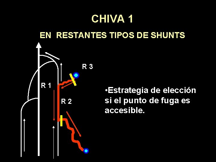 CHIVA 1 EN RESTANTES TIPOS DE SHUNTS R 3 R 1 R 2 •