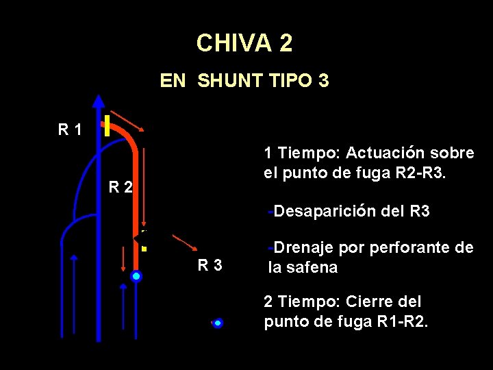 CHIVA 2 EN SHUNT TIPO 3 R 1 1 Tiempo: Actuación sobre el punto