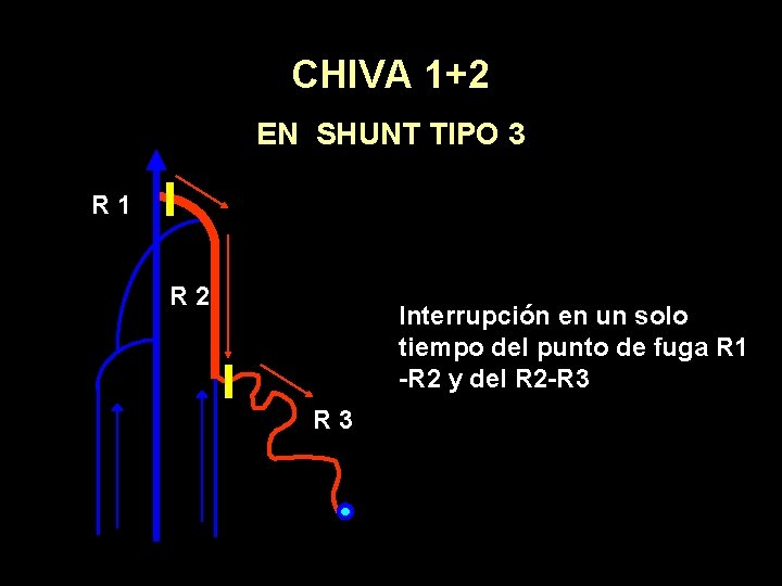 CHIVA 1+2 EN SHUNT TIPO 3 R 1 R 2 Interrupción en un solo