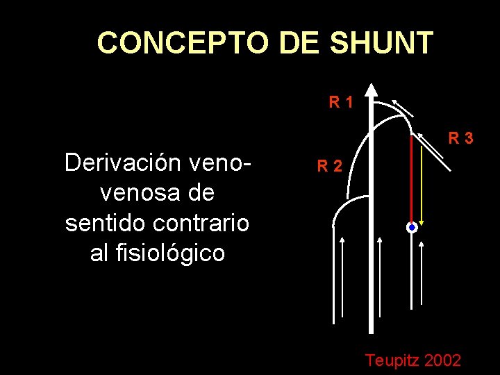 CONCEPTO DE SHUNT R 1 R 3 Derivación venosa de sentido contrario al fisiológico