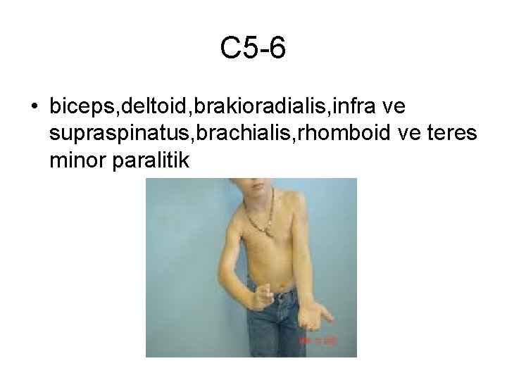 C 5 -6 • biceps, deltoid, brakioradialis, infra ve supraspinatus, brachialis, rhomboid ve teres