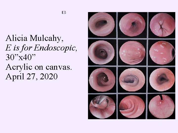 E 3 Alicia Mulcahy, E is for Endoscopic, 30”x 40” Acrylic on canvas. April
