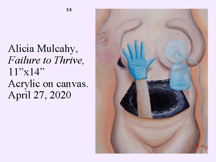 E 4 Alicia Mulcahy, Failure to Thrive, 11”x 14” Acrylic on canvas. April 27,