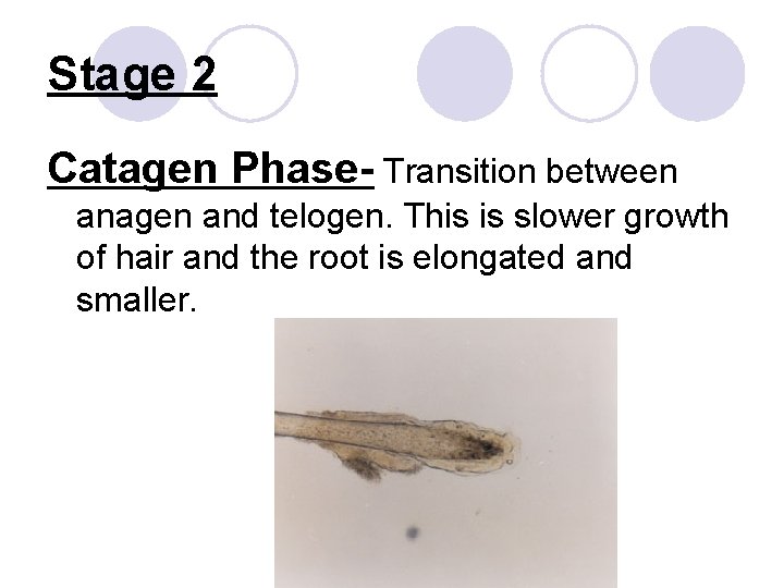 Stage 2 Catagen Phase- Transition between anagen and telogen. This is slower growth of