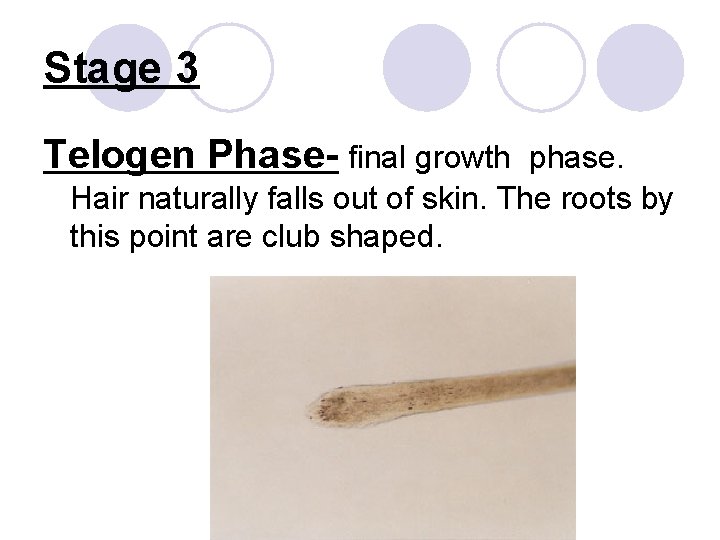Stage 3 Telogen Phase- final growth phase. Hair naturally falls out of skin. The