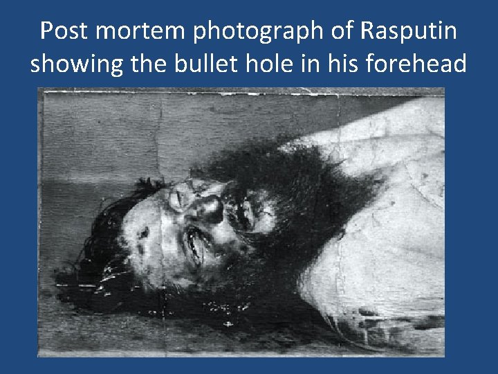 Post mortem photograph of Rasputin showing the bullet hole in his forehead 