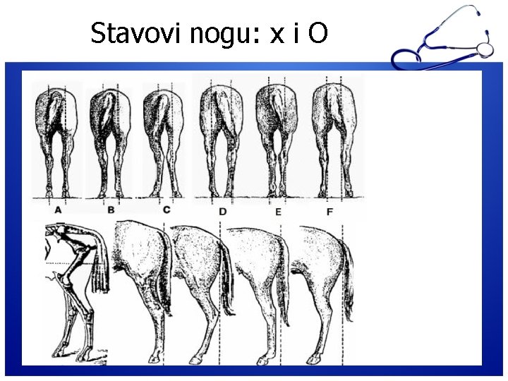 Stavovi nogu: x i O 