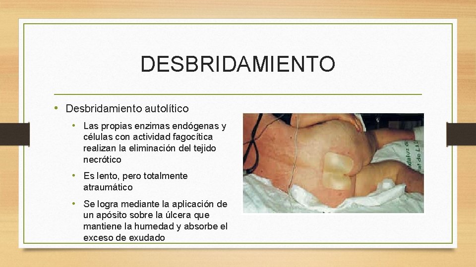 DESBRIDAMIENTO • Desbridamiento autolítico • Las propias enzimas endógenas y células con actividad fagocítica