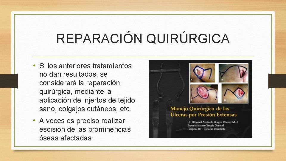 REPARACIÓN QUIRÚRGICA • Si los anteriores tratamientos no dan resultados, se considerará la reparación