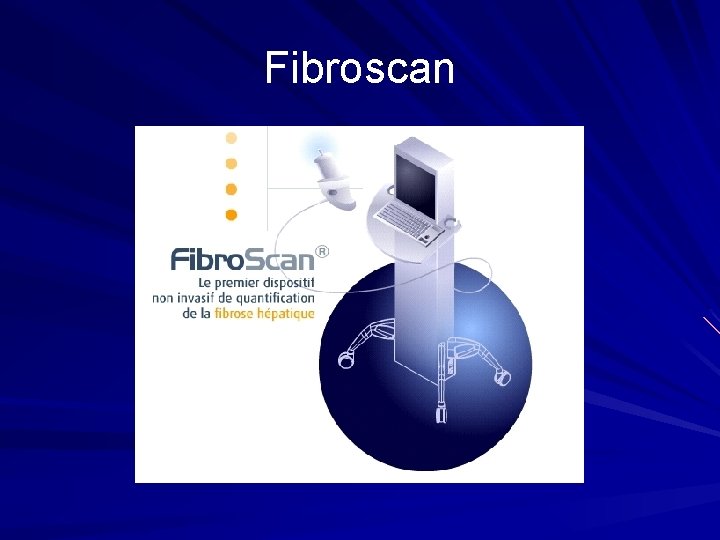 Fibroscan 