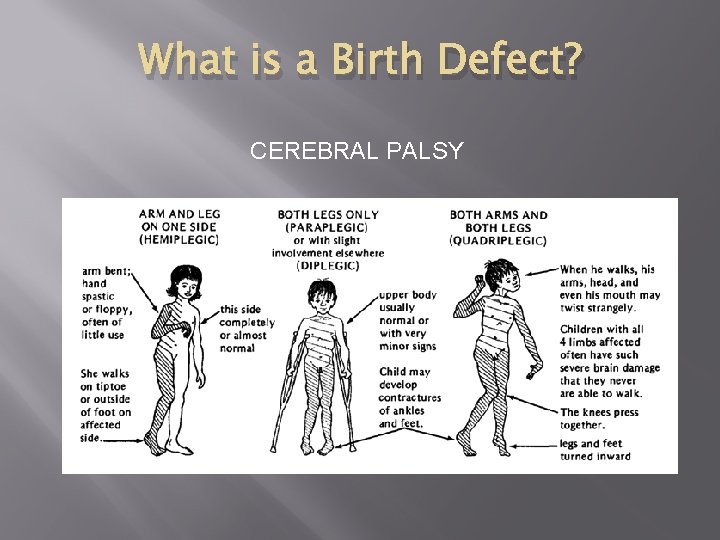UNDERSTANDING BIRTH DEFECTS Prevention Detection Treatment What is