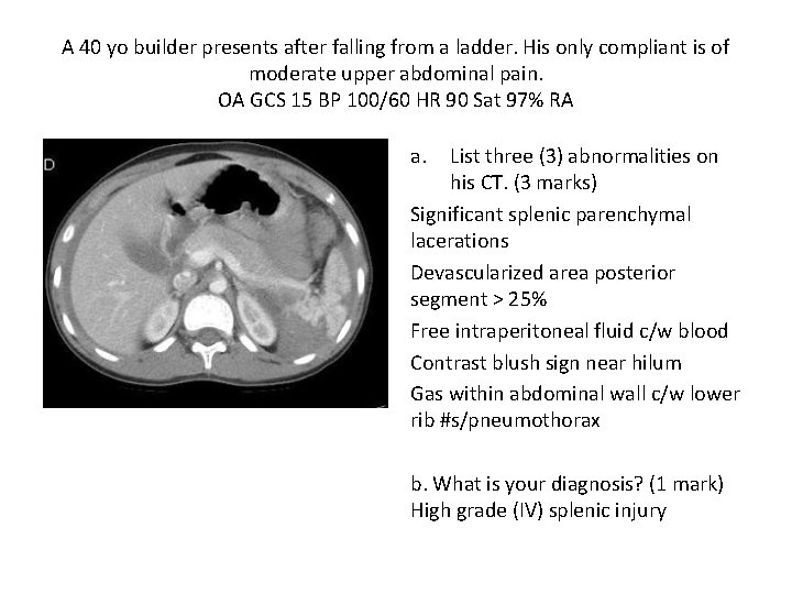 A 40 yo builder presents after falling from a ladder. His only compliant is