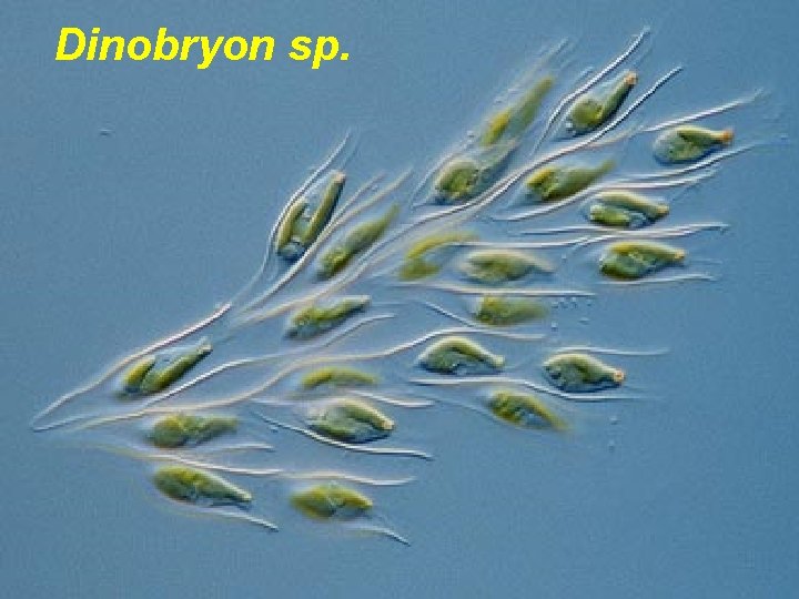 Dinobryon sp. Dinobryon sp.