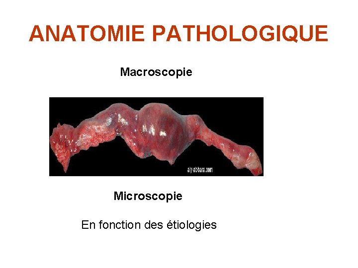 ANATOMIE PATHOLOGIQUE Macroscopie Microscopie En fonction des étiologies 