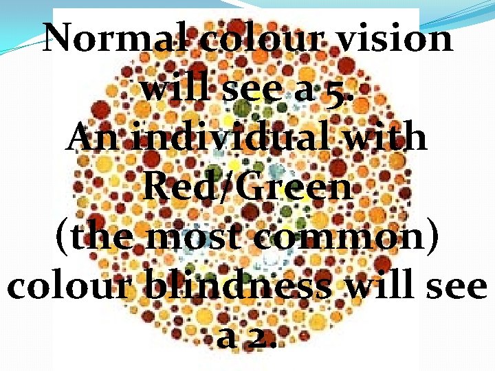 Normal colour vision will see a 5. An individual with Red/Green (the most common)