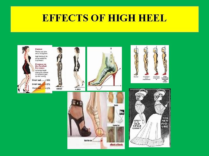 EFFECTS OF HIGH HEEL 