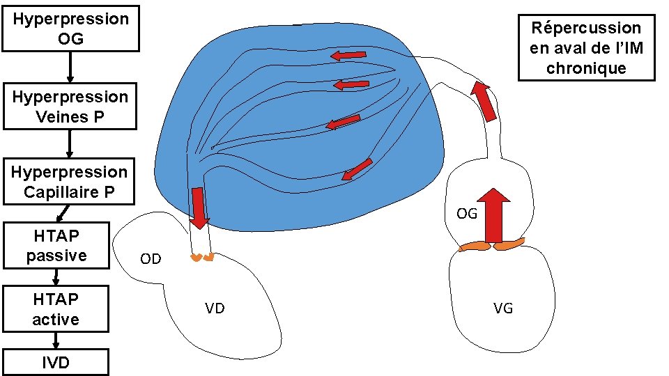 Hyperpression OG Répercussion en aval de l’IM chronique Hyperpression Veines P Hyperpression Capillaire P