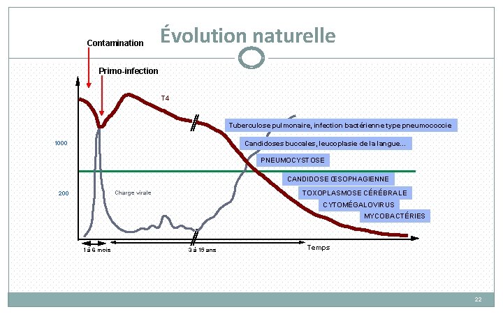 Contamination Évolution naturelle Primo-infection T 4 Tuberculose pulmonaire, infection bactérienne type pneumococcie Candidoses buccales,