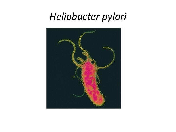 Heliobacter pylori 