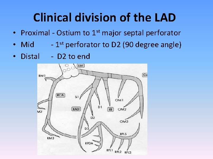 Clinical division of the LAD • Proximal - Ostium to 1 st major septal