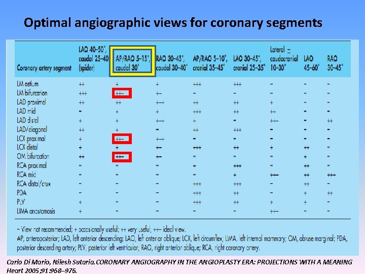 Optimal angiographic views for coronary segments Carlo Di Mario, Nilesh Sutaria. CORONARY ANGIOGRAPHY IN