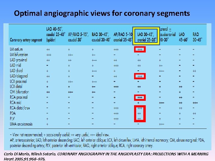 Optimal angiographic views for coronary segments Carlo Di Mario, Nilesh Sutaria. CORONARY ANGIOGRAPHY IN