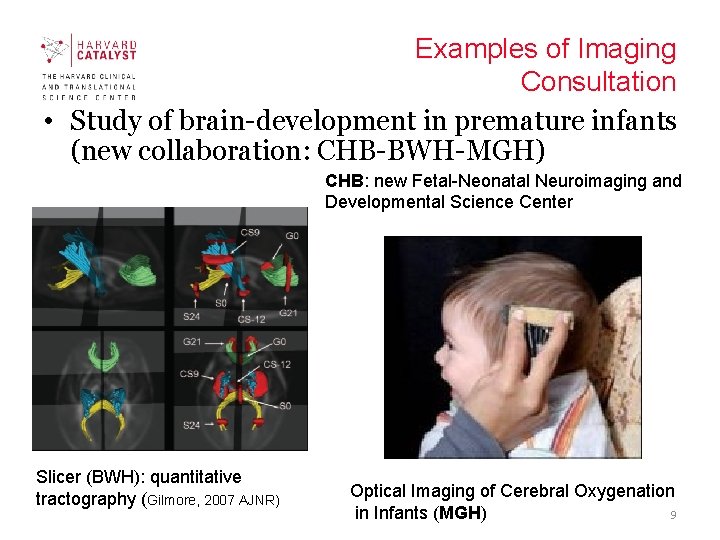 Examples of Imaging Consultation • Study of brain-development in premature infants (new collaboration: CHB-BWH-MGH)