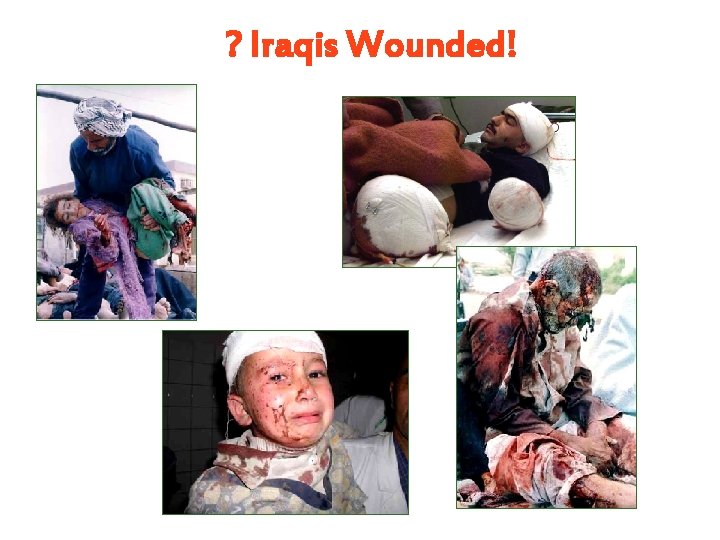 ? Iraqis Wounded! ? Iraqis Wounded!