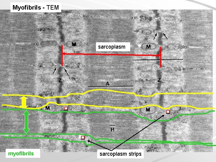 Myofibrils - TEM sarcoplasm myofibrils sarcoplasm strips 