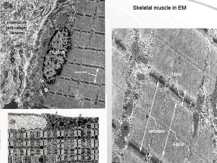 Skeletal muscle in EM 