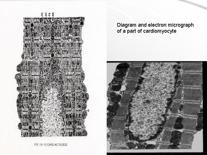 Diagram and electron micrograph of a part of cardiomyocyte 