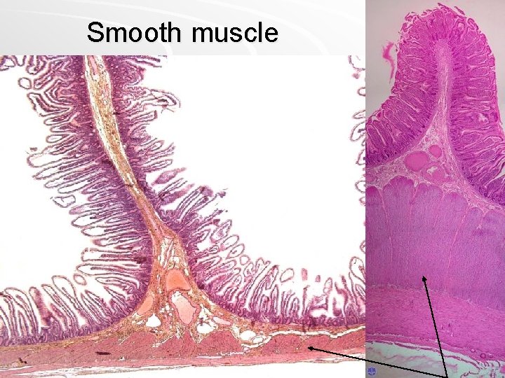 Smooth muscle 