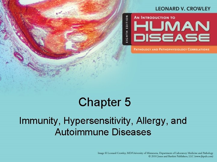 Chapter 5 Immunity, Hypersensitivity, Allergy, and Autoimmune Diseases 