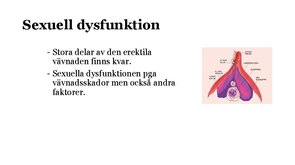 Sexuell dysfunktion - Stora delar av den erektila vävnaden finns kvar. - Sexuella dysfunktionen