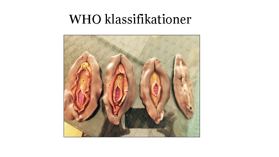 WHO klassifikationer 