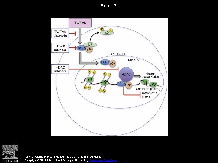 Figure 9 Kidney International 2016 89399 -410 DOI: (10. 1038/ki. 2015. 332) Copyright ©