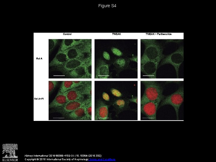 Figure S 4 Kidney International 2016 89399 -410 DOI: (10. 1038/ki. 2015. 332) Copyright