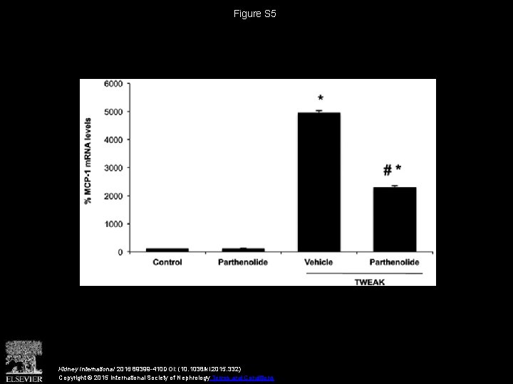 Figure S 5 Kidney International 2016 89399 -410 DOI: (10. 1038/ki. 2015. 332) Copyright