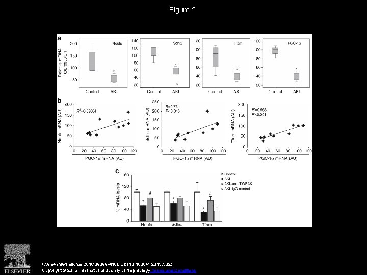 Figure 2 Kidney International 2016 89399 -410 DOI: (10. 1038/ki. 2015. 332) Copyright ©