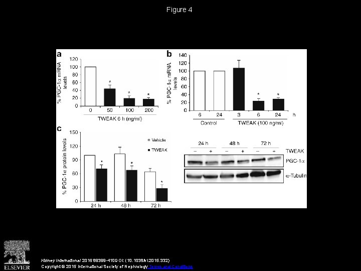 Figure 4 Kidney International 2016 89399 -410 DOI: (10. 1038/ki. 2015. 332) Copyright ©