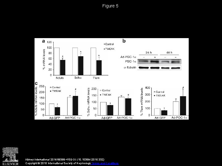 Figure 5 Kidney International 2016 89399 -410 DOI: (10. 1038/ki. 2015. 332) Copyright ©