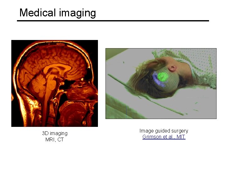 Medical imaging 3 D imaging MRI, CT Image guided surgery Grimson et al. ,