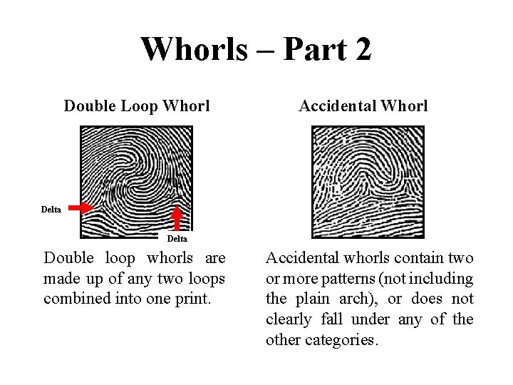 Whorls – Part 2 Double Loop Whorl Accidental Whorl Delta Double loop whorls are
