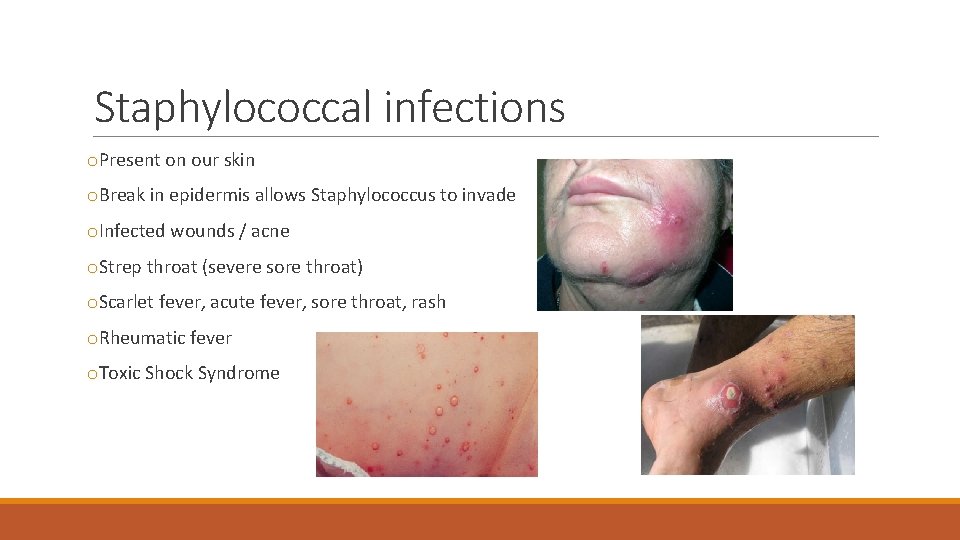 Staphylococcal infections o. Present on our skin o. Break in epidermis allows Staphylococcus to