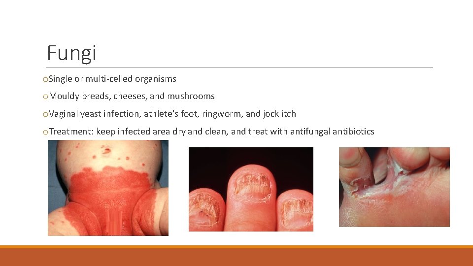 Fungi o. Single or multi-celled organisms o. Mouldy breads, cheeses, and mushrooms o. Vaginal