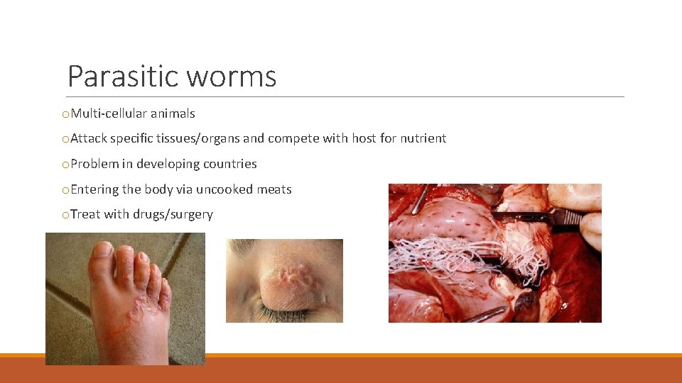 Parasitic worms o. Multi-cellular animals o. Attack specific tissues/organs and compete with host for