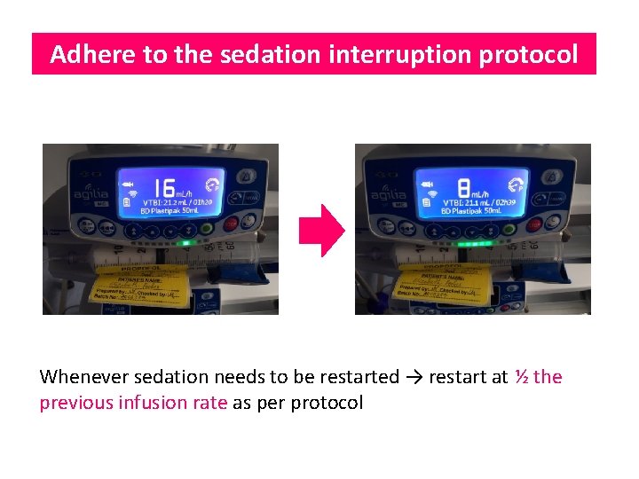 Adhere to the sedation interruption protocol Whenever sedation needs to be restarted → restart