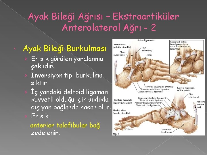 Ayak Bileği Ağrısı – Ekstraartiküler Anterolateral Ağrı - 2 Ayak Bileği Burkulması › En