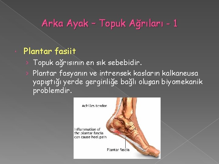 Arka Ayak – Topuk Ağrıları - 1 Plantar fasiit › Topuk ağrısının en sık