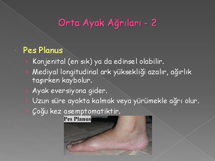 Orta Ayak Ağrıları - 2 Pes Planus › Konjenital (en sık) ya da edinsel